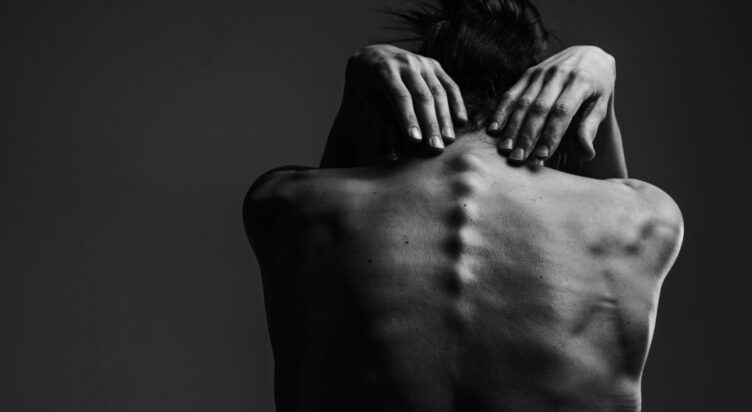 AC350 Acupuncture Anatomy