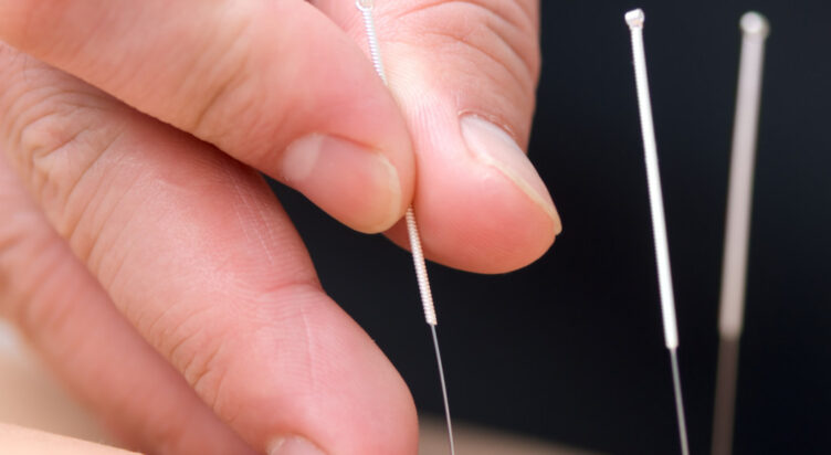 AC470 Acupuncture Energetics III