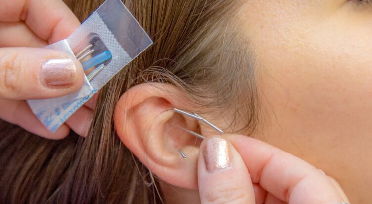 EL620 Topics in Classical Acupuncture
